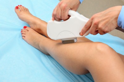 Épilation laser
